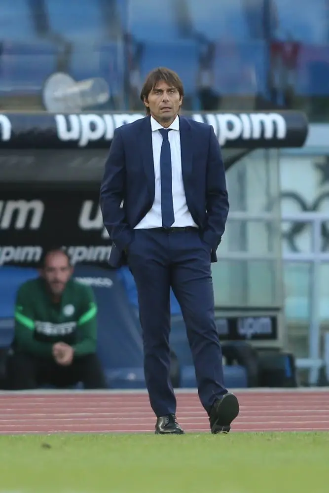 Antonio Conte Hair transplant 3