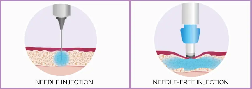 needle & needle free injection