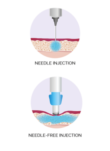 Needle-Free Injection | Pain-Free Solution For Anaesthesia