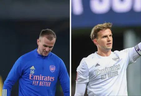 Rob Holding hair transplant