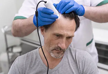 man getting hair loss treatment scaled