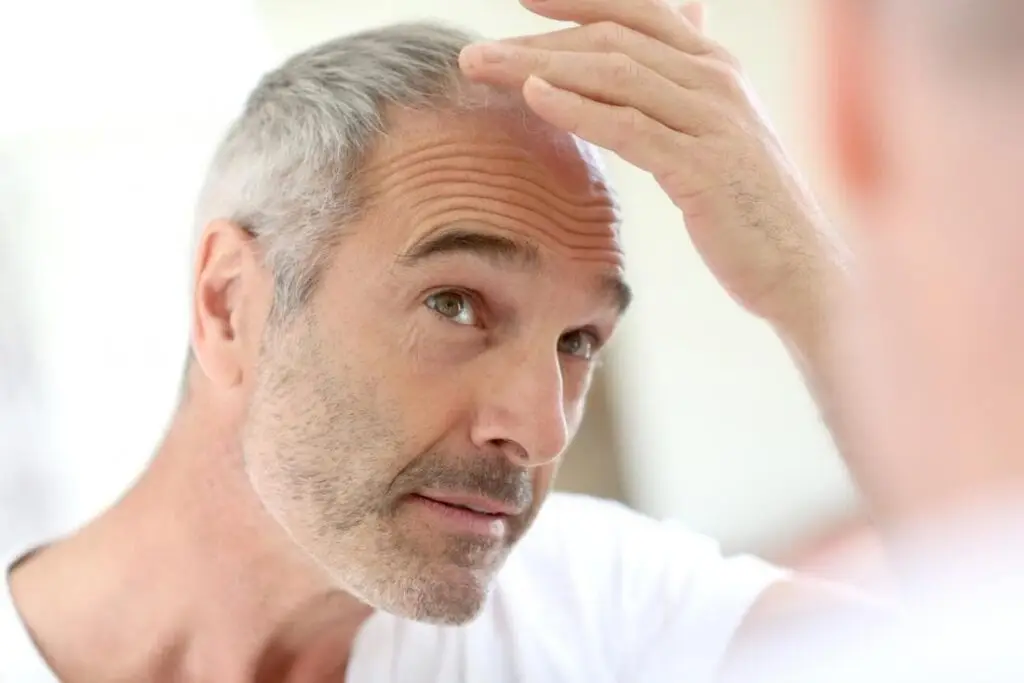 Diabetes hair loss men