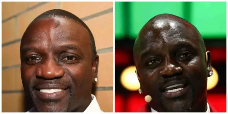 Akon's hair loss 2019