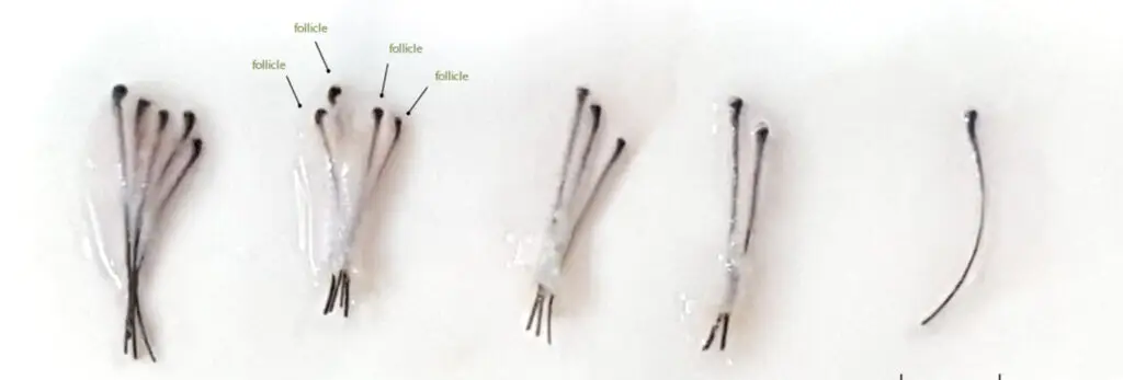 Follicular units