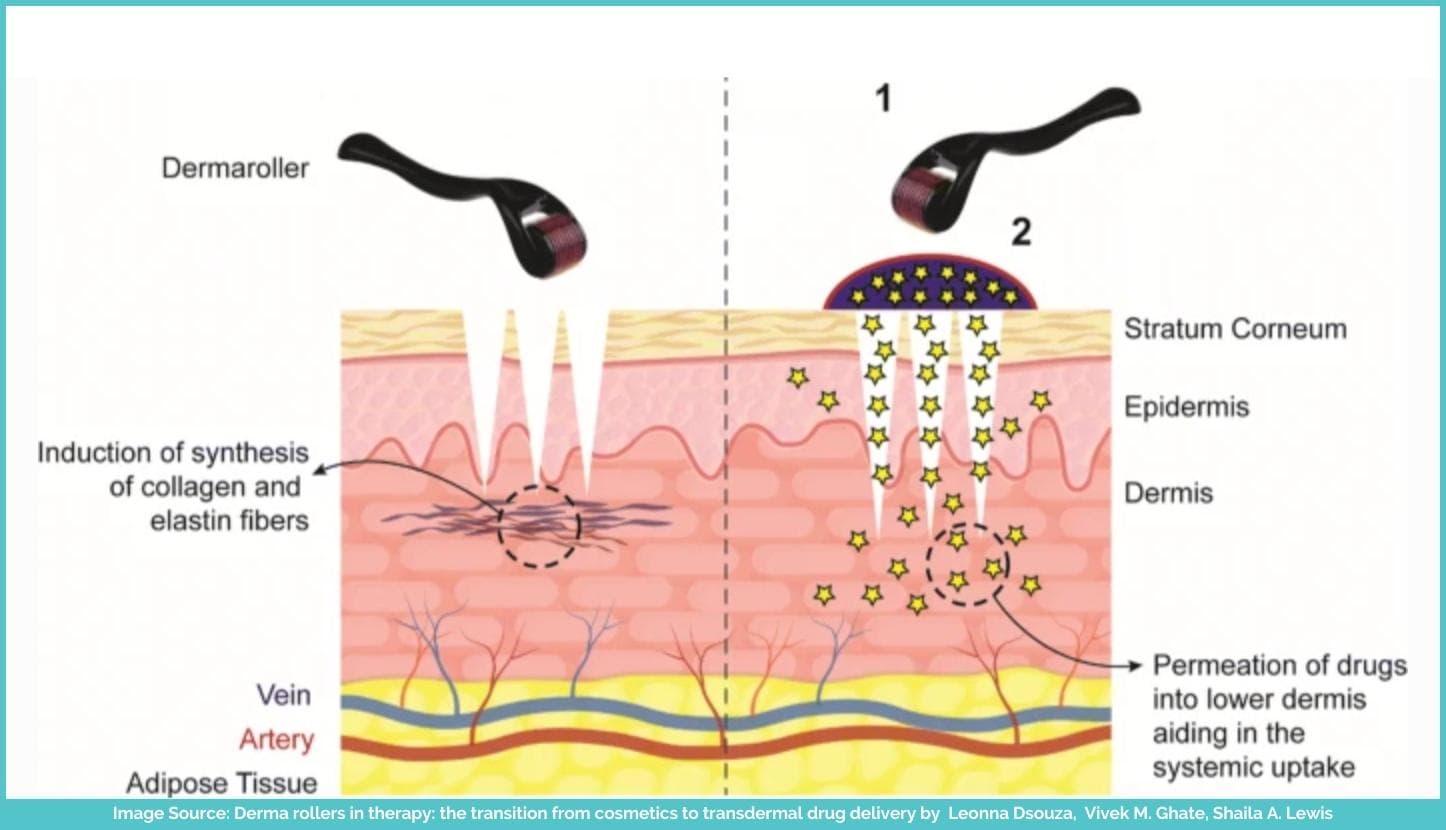 Derma Roller For Hair Growth: How To Use, Benefits & Harms