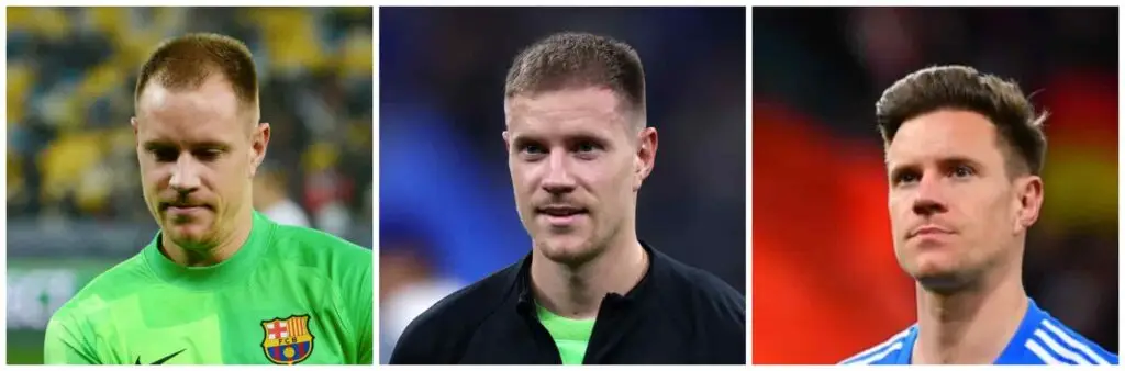 Ter Stegen before and after hair transplant