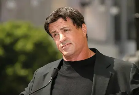 Sylvester Stallone hair transplant