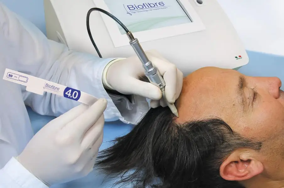 Biofibre hair transplant