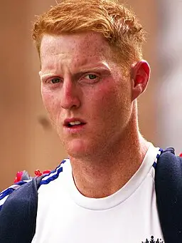 Ben Stokes before hair transplant