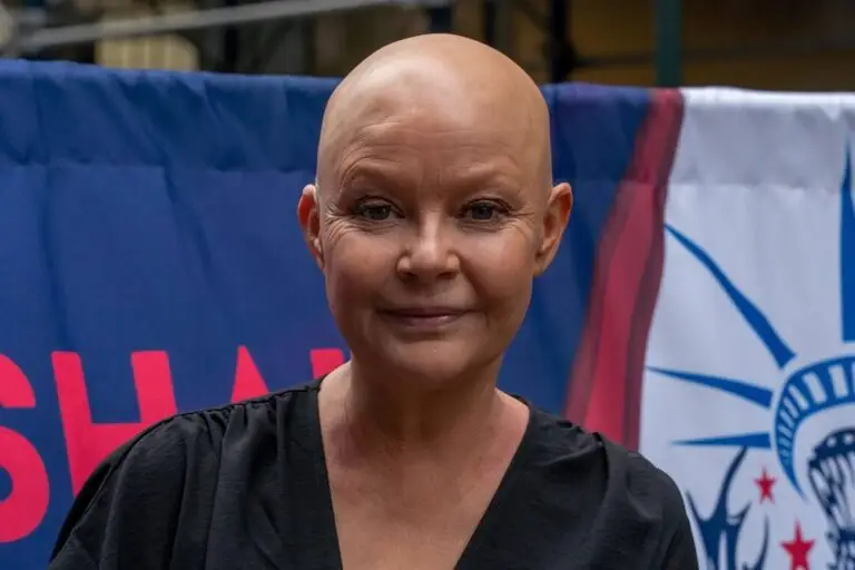 Gail Porter bald