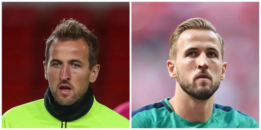 Harry Kane hairdos