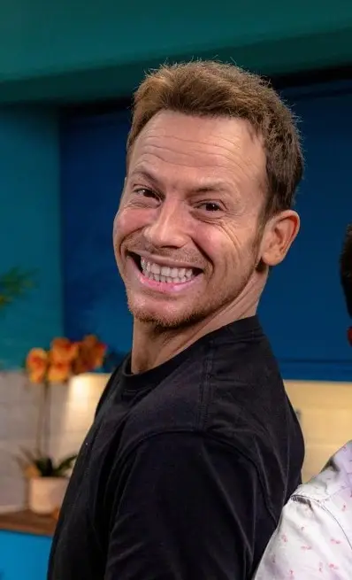 Joe Swash After Hair Transplant