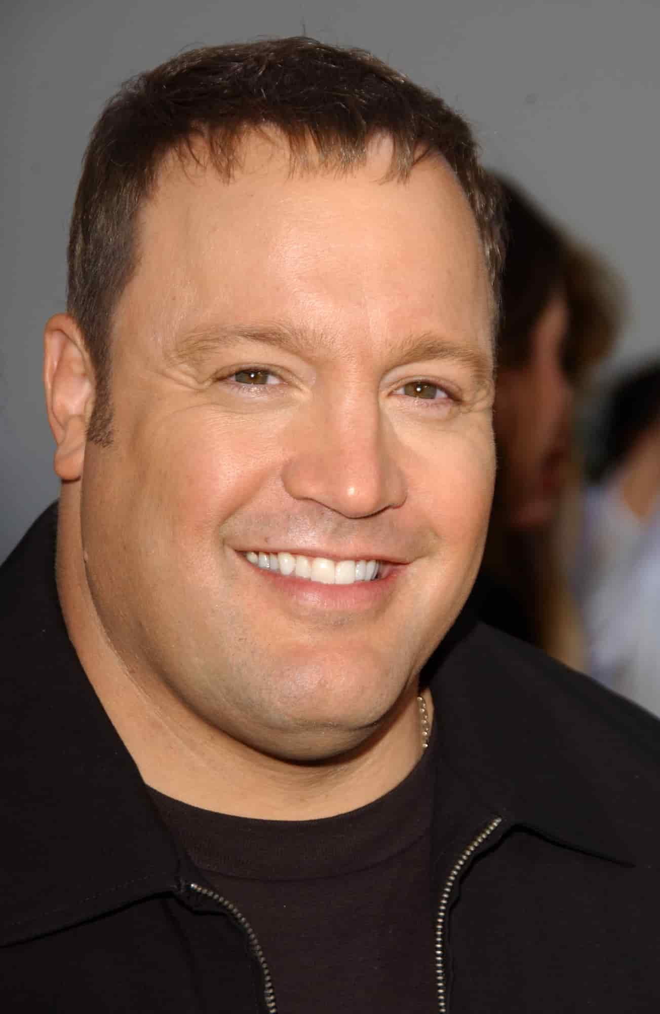 Kevin James Hair Transplant | Longevita