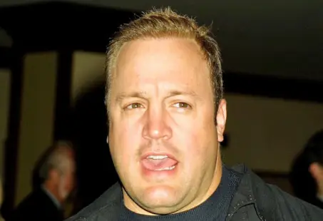 Kevin James hair transplant