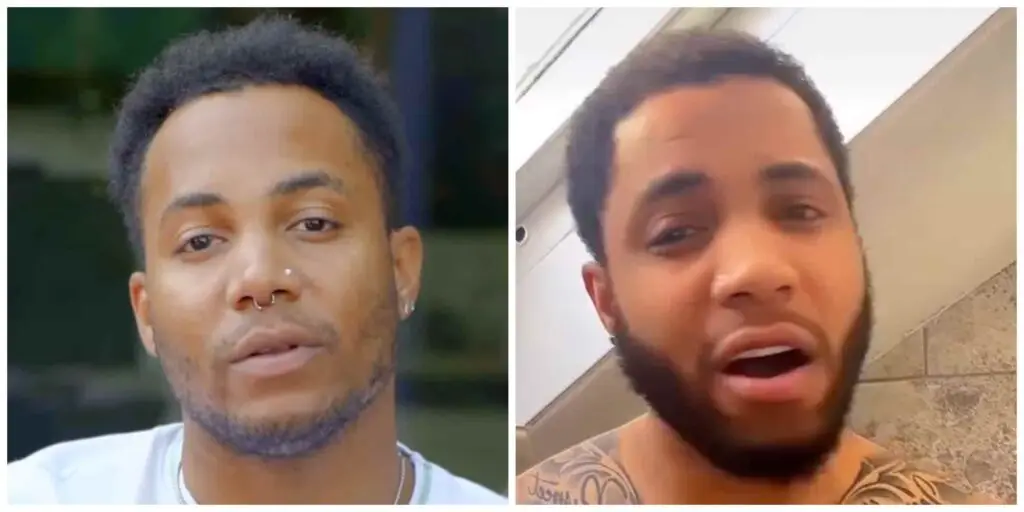 Matthew Larmond before and after hair transplant