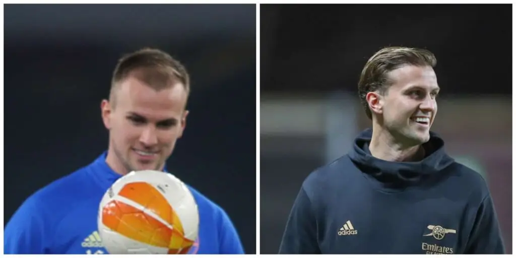 Rob Holding hair transplant before and after