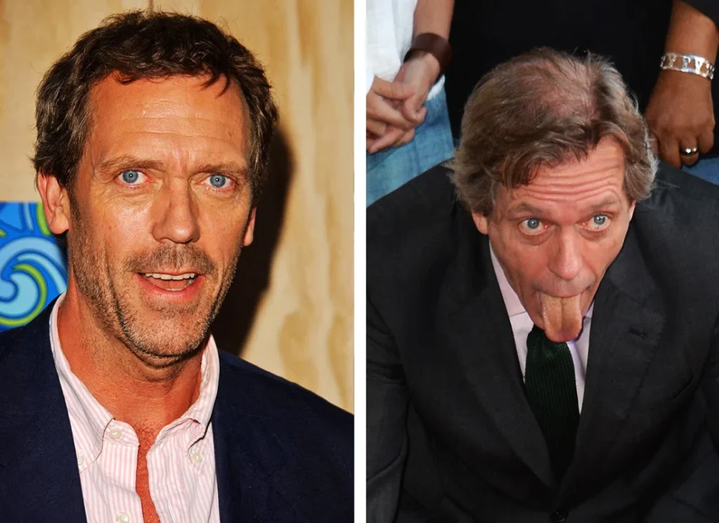 hugh laurie hair 6