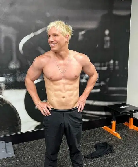 jamie laing after hair transplant 