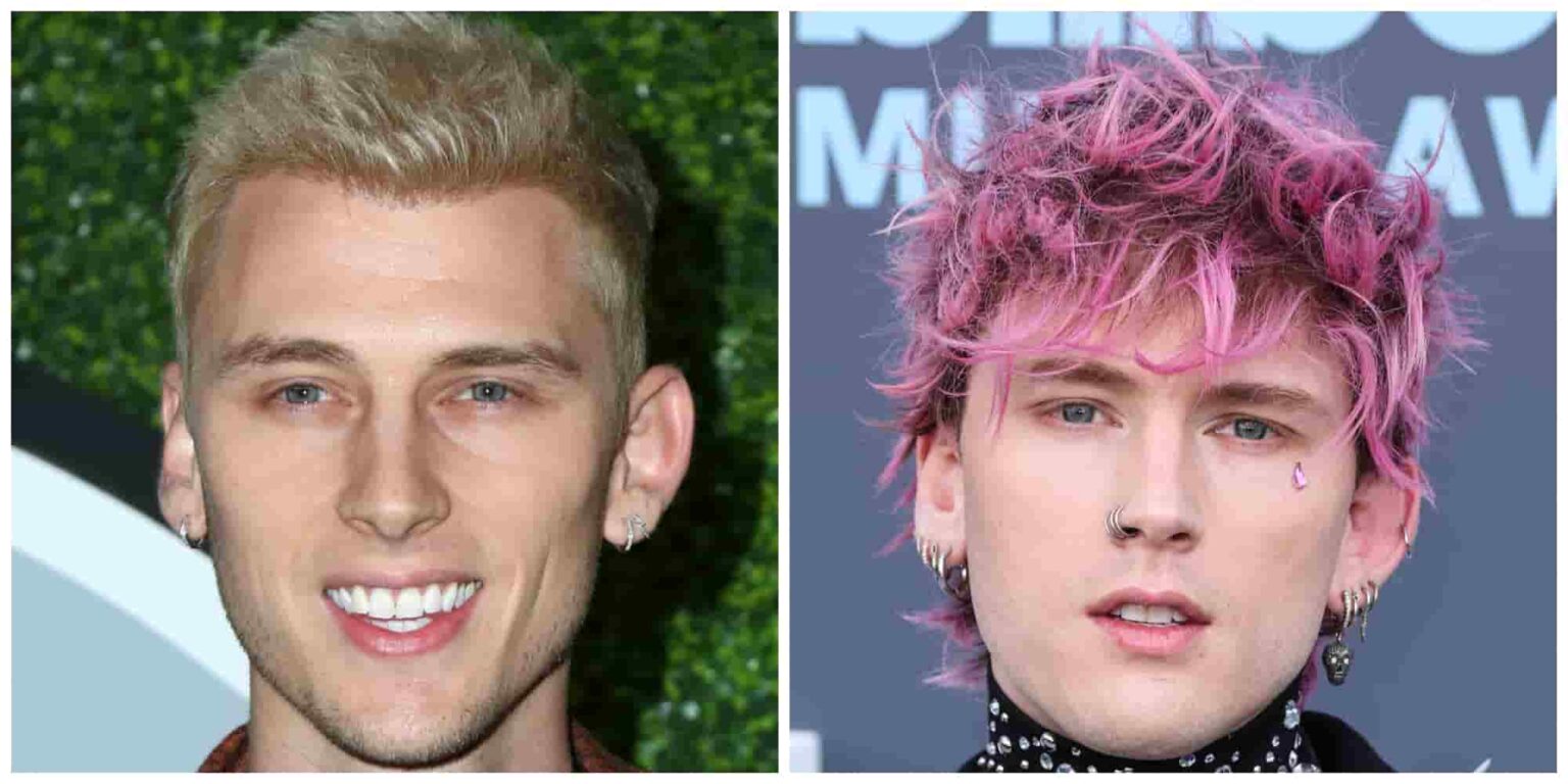 Machine Gun Kelly MGK Hair Transplant Did It Happen? Longevita