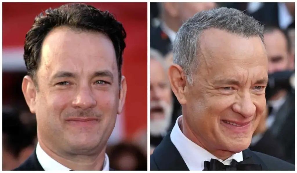 Tom Hanks hair then vs now