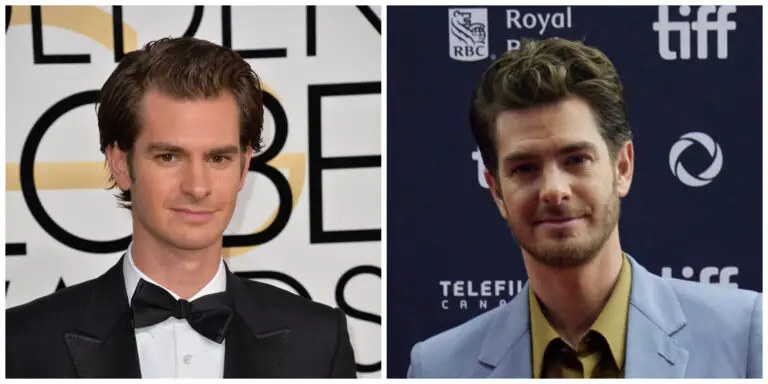 andrew garfield before and after hair transplant