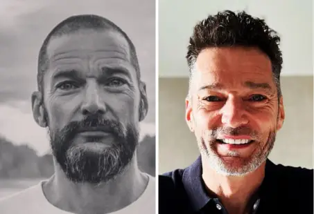 Fred Sirieix hair transplant rumours