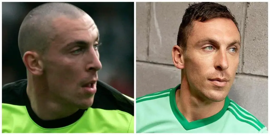 Scott Brown with and without hair