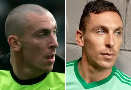 scott brown hair transplant