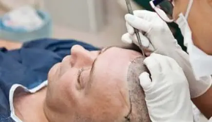 FUE Hair Transplant in Turkey