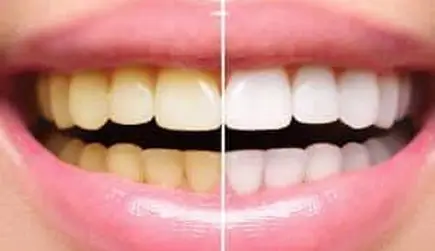 cosmetic dentistry