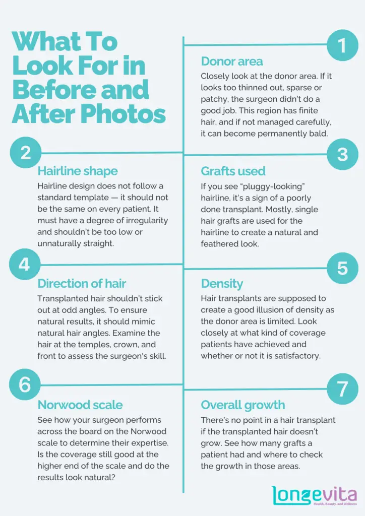 what to look for in before and after hair transplant photos