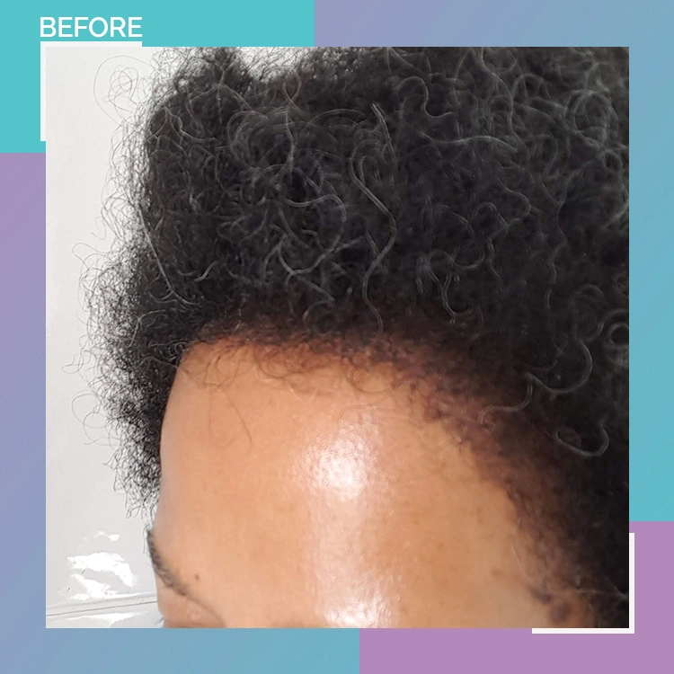 afro B A 10 after