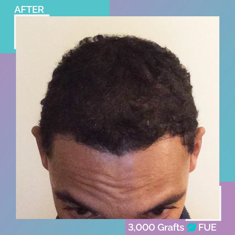 afro B A 2 after