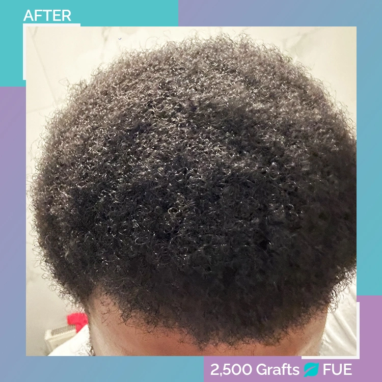 afro B A 8 after