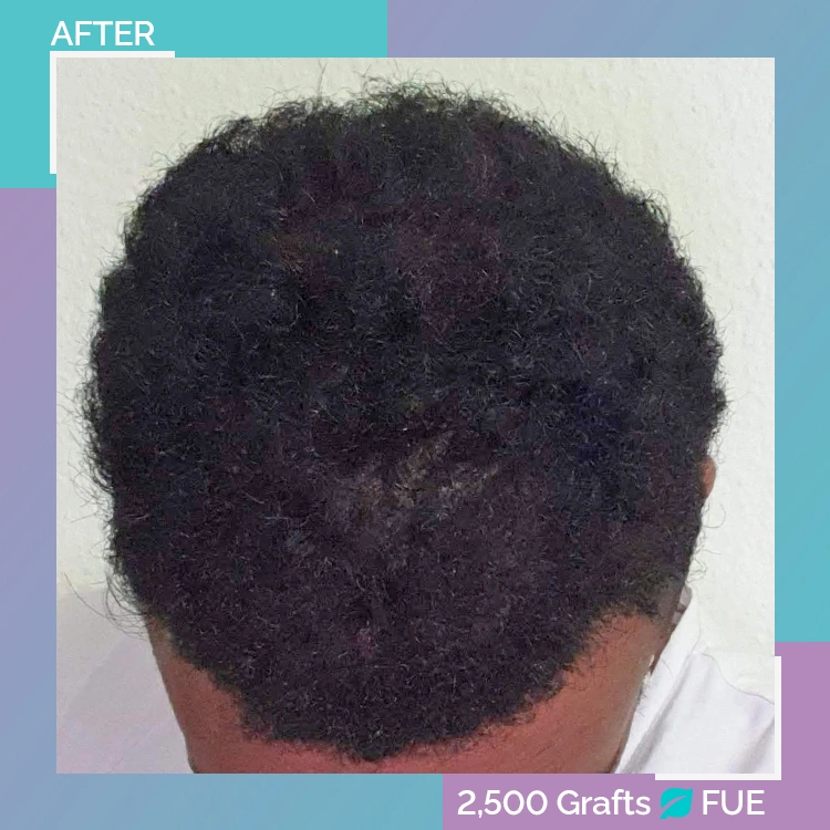 afro B A 9 after