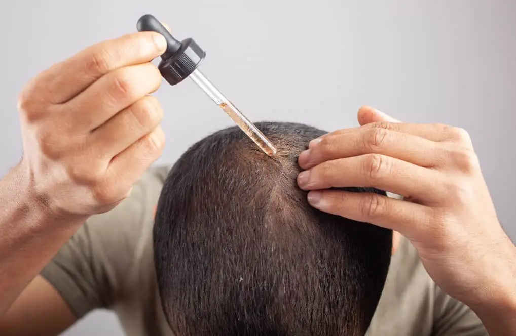 man using minoxidil