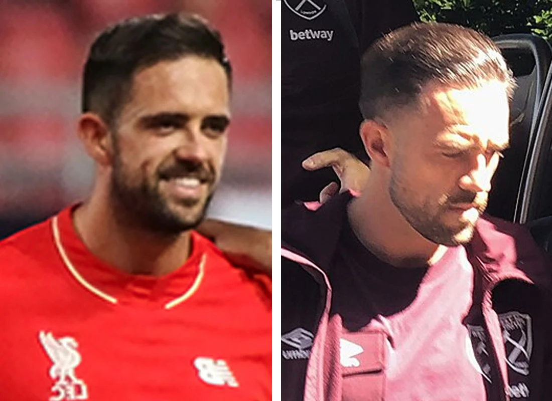 Danny Ings before after